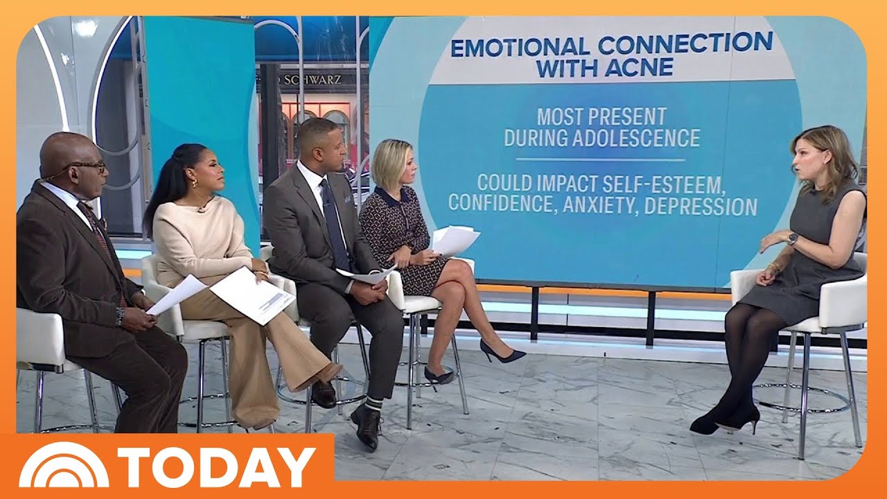 What to Know About Acne: Causes, Remedies, Prevention