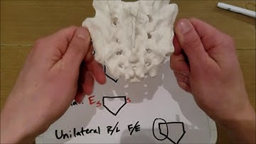 AOCPMR OMT: Walkthrough of Osteopathic Sacral Dysfunctions