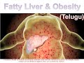 Fatty liver  obesity telugu