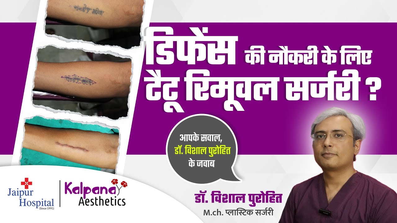 Tattoo Removal Surgery for Joining Defense Job ? | डिफेंस की नौकरी के लिए टैटू रिमूवल सर्जरी ?