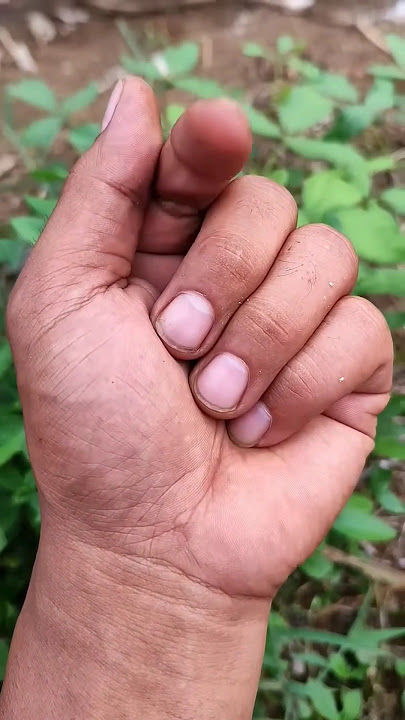 Asian beetles you've never seen🐜🐜🌿😱🤪😲#anyuniqueanimals#beetle#insects#beautifulinsects#nature#p4487