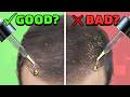 Dandruff Hurts AND Also Helps Our Hair Loss?! (Explaining the Science)