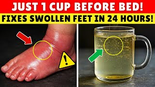 GOODBYE Swelling!  5 Bedtime Fixes That Drain Swollen Legs Overnight | Senior Health Tips
