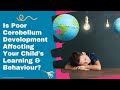 CEREBELLUM ANATOMY | How it Affects Your Child&#39;s Learning &amp; Behaviour