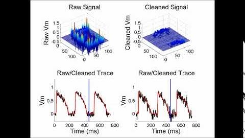 Cardiac tissue slices: preparation, handling, and successful optical mapping