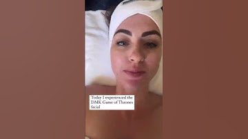 Game Of Thrones DMK Facial Review