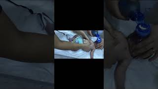 عملية الانعاش القلبي الرئوي لطفل حديث الولادة CPR