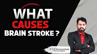 Hi9 | What Causes Brain Stroke ? | Dr KV Shivanand Reddy, Neurosurgeon