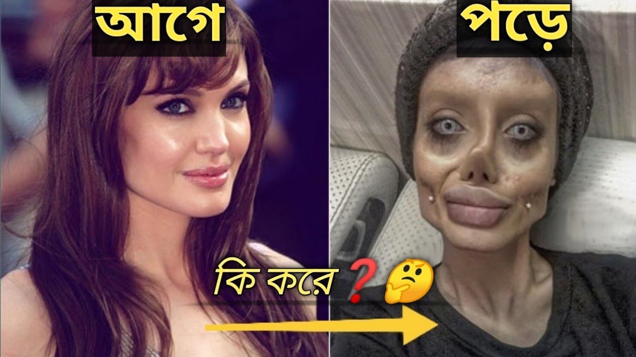 6 People Who Took Plastic Surgery Sahar Tabar Biki Pandit