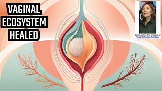 Heal Your Vaginal Ecosystem With Linda Allen’s 5 Protocols