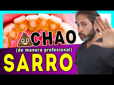 Te 𝙀𝙭𝙥𝙡𝙞𝙘𝙤 como 𝗤𝗨𝗜𝗧𝗔𝗥 el 𝗦𝗔𝗥𝗥𝗢 💩 de los DIENTES . Así LIMPIAN los DIENTES los DENTISTAS (3 𝗠𝗲𝘁𝗼𝗱𝗼𝘀)