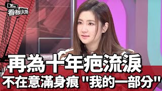 Selina任家萱 再為十年疤流淚 不在意滿身痕 '我的一部分' 看板人物 20220515 (1/1)