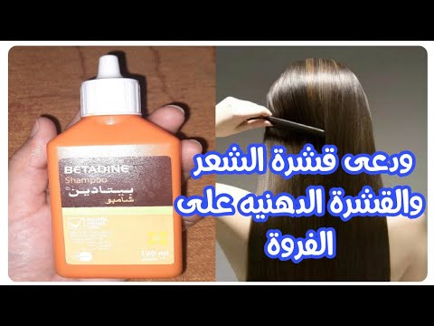 حل فعال لقشرة الشعر والتهاب الجلد الدهنى والتخلص نهائيا منه