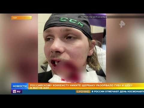 Российскому хоккеисту разорвало рот в матче АХЛ