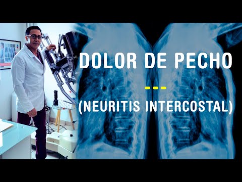 Vídeo: Neuralgia Del Pecho