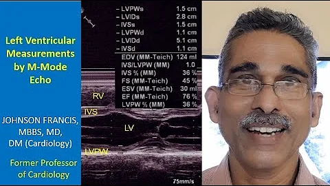 Left Ventricular Measurements by M-Mode Echo
