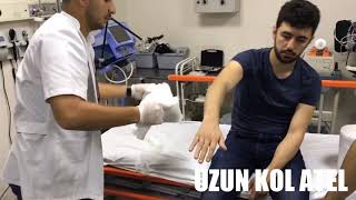 Uzun Kol Ateli̇ Yapilişi