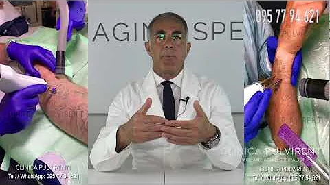Quanto costa la rimozione di un tatuaggio?