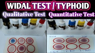 Widal Test Practical | Qualitative Widal Test | Quantitative Widal Test | Typhoid Test