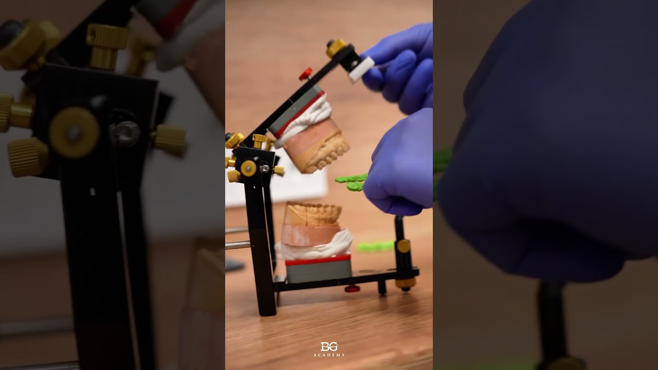 Test bite in new mandible position. 