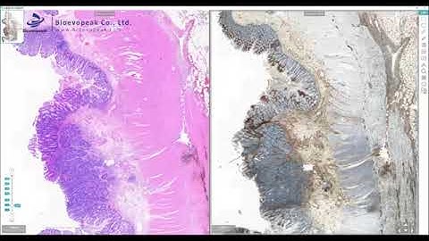 Digital Pathology Slide Scanner, PSS-60