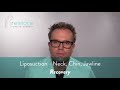 Liposuction Neck, Chin, Jawline Recovery -Recovery