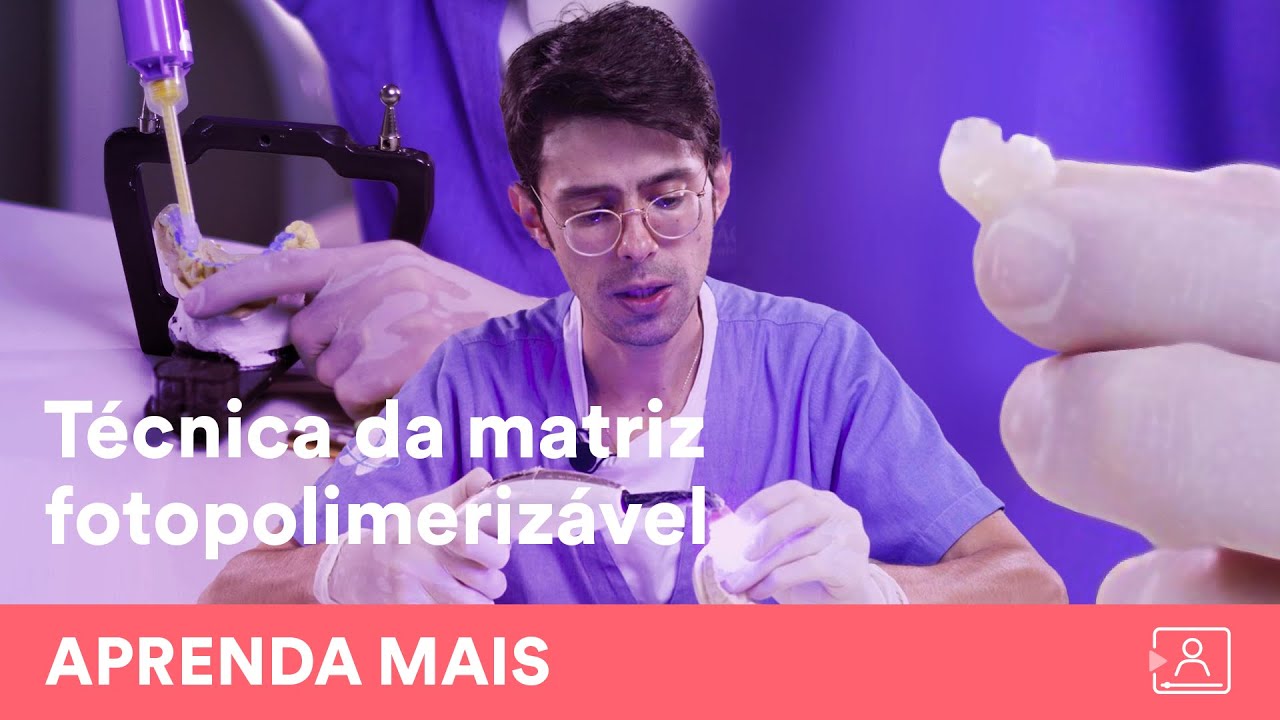 Confeccione onlays, overlays e inlays através de MATRIZES FOTOPOLIMERIZÁVEIS.