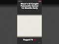 Mayo's AI Caught Pancreatic Cancer 16 Months Early #Shorts
