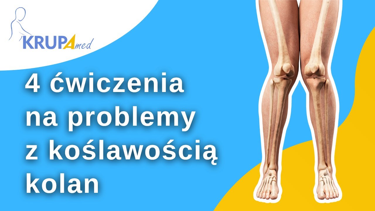 4 ćwiczenia na problemy z koślawością kolan