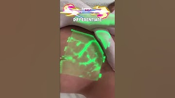 VeinViewer: Visualizing Vein Location