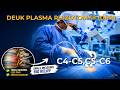 Watch Live Neck Surgery - Cervical Spine Surgery For Herniated Discs | Deuk Spine
