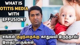 What is Otitis Media with Effusion OME| Dr. Vignesh Gokul ENT Doctor