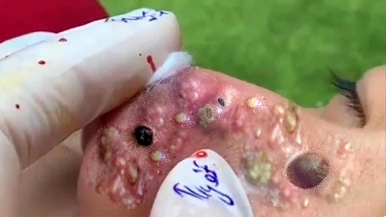 𝑅𝑒𝑐𝑙𝑎𝑖𝑚 𝑌𝑜𝑢𝑟 𝐺𝑙𝑜𝑤 𝐴𝑛𝑑 𝐶𝑎𝑙𝑚 𝑇ℎ𝑟𝑜𝑢𝑔ℎ 𝑀𝑖𝑛𝑑𝑓𝑢𝑙 𝑆𝑘𝑖𝑛𝑐𝑎𝑟𝑒 𝑀𝑜𝑚𝑒𝑛𝑡𝑠 