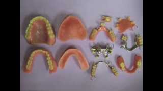Care of Removable Partials and Dentures 2013