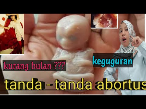 Video: Tanda-tanda Keluarga Sebagai Sebuah Institusi