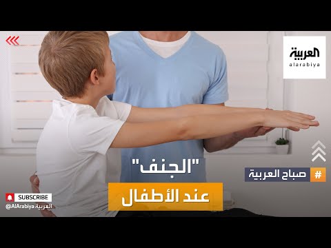 فيديو: كيفية علاج الجنف عند الأطفال