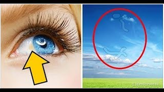 12 Things Your Eyes Can Tell About Your Health