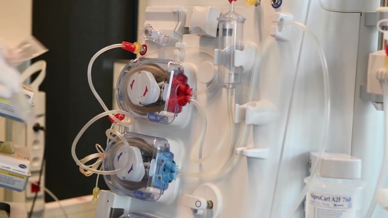 Unipunción Doble Bomba en Surdial X: Montaje y Cebado con DIF