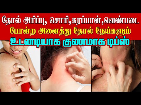 அனைத்து தோல் நோய்களும் குணமாக டிப்ஸ் / Home remedies for itching skin in Tamil - Health Tips