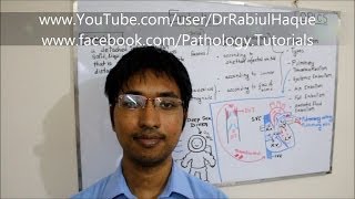 Embolism : Definition, Types, Pathogenesis, Clinical Consequences (HD)