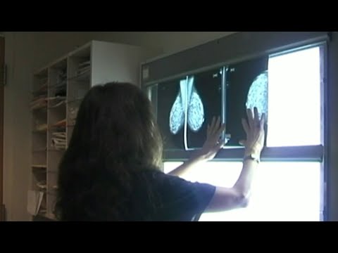Wideo: Czy delikatne piersi mogą być oznaką raka?
