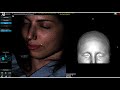 7d surgical system  cranial workflow demonstration