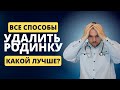 Как удалить родинку? | Хирургические способы удаления невусов на лице и теле | Плюсы и минусы