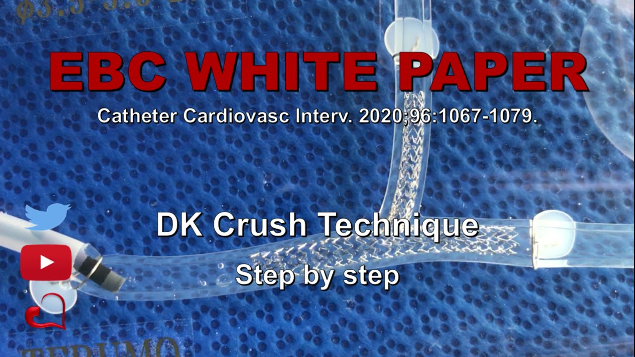 Técnicas en Bifurcaciones: DK Crush In Vitro