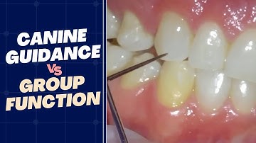 Canine Guidance vs Group Function - Does it Matter?! - PDP182