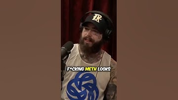 Post Malone talks about drug addiction!