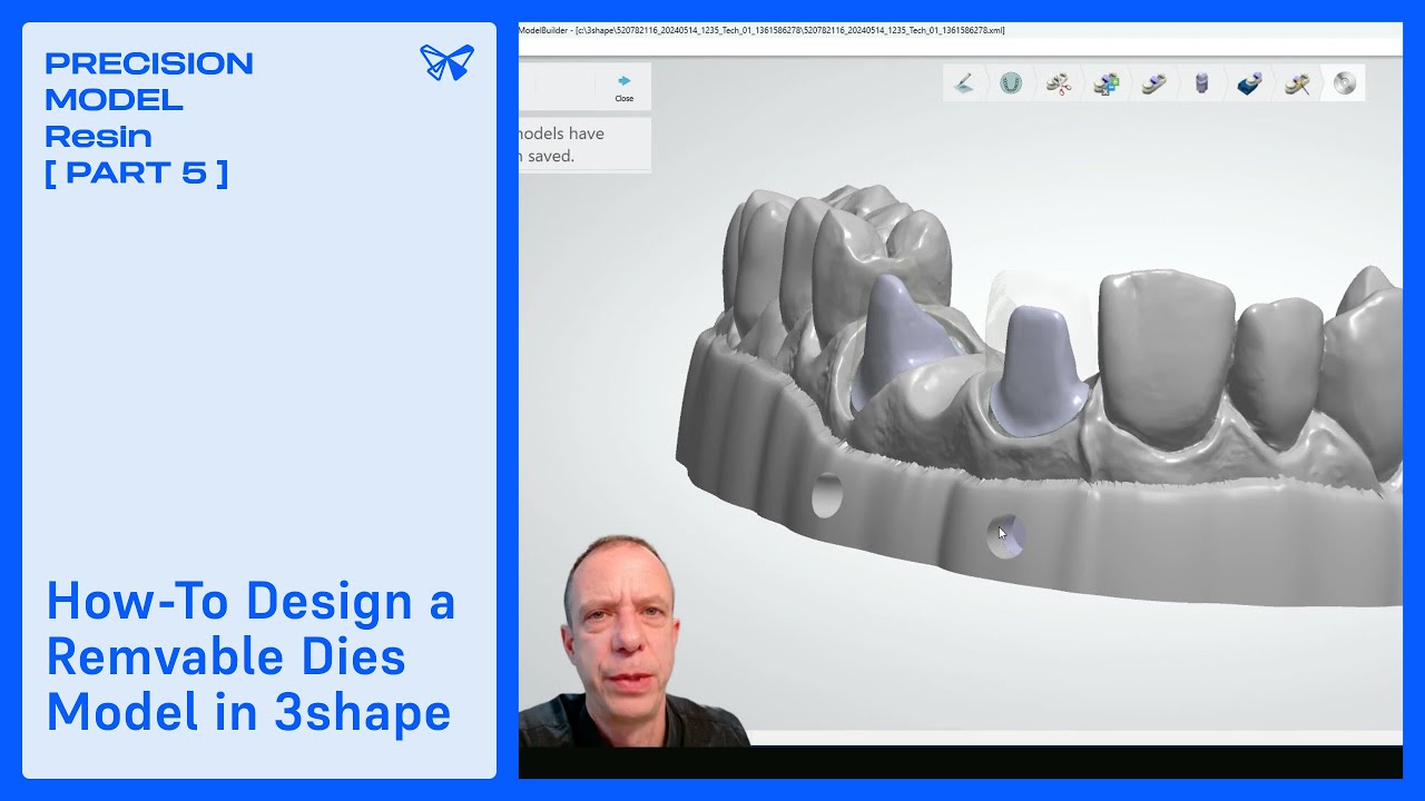 Model Build 3shape How-To Design a Removable Dies Model in 3shape© | Precision Model Resin ...