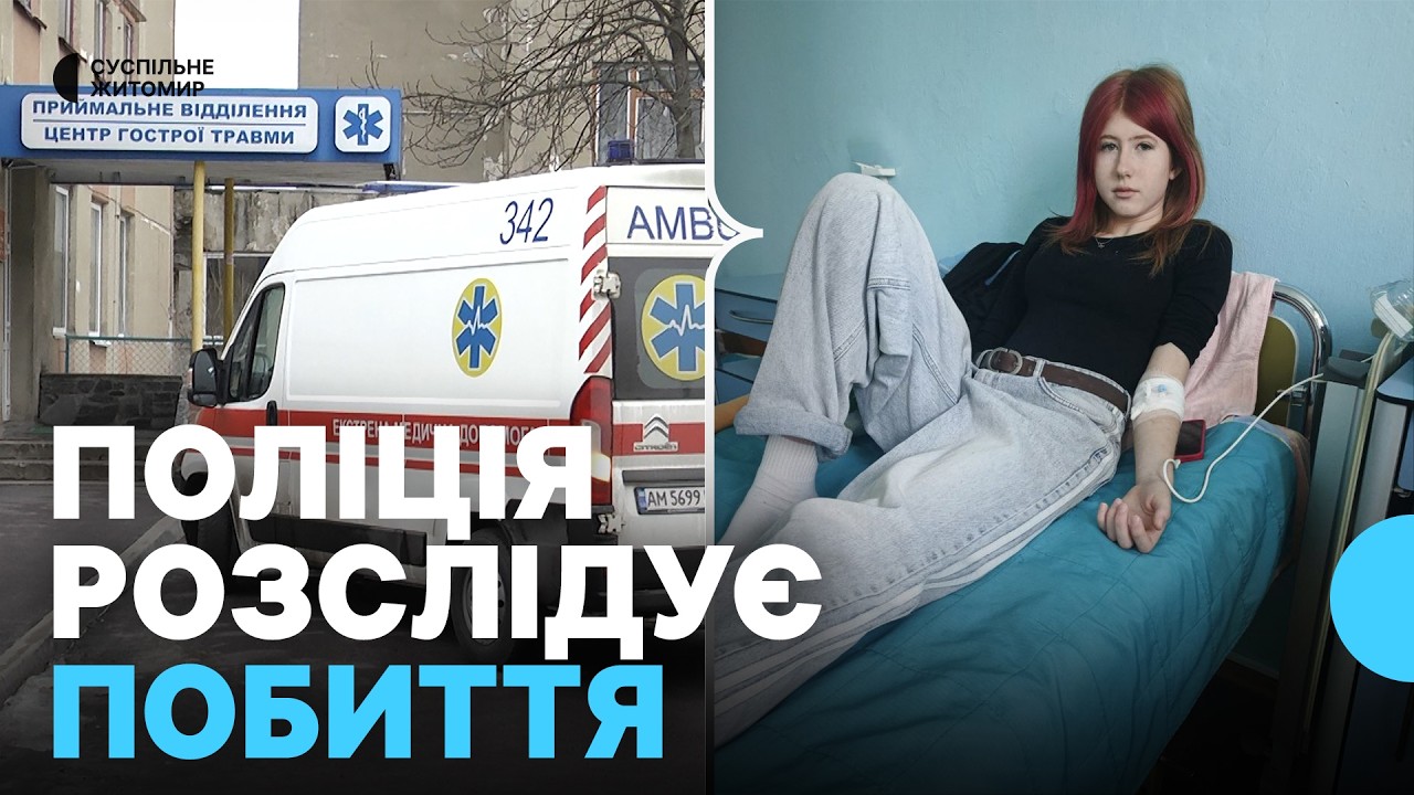 Поліція розслідує справу про побиття 14-річної дівчини у центрі Житомира