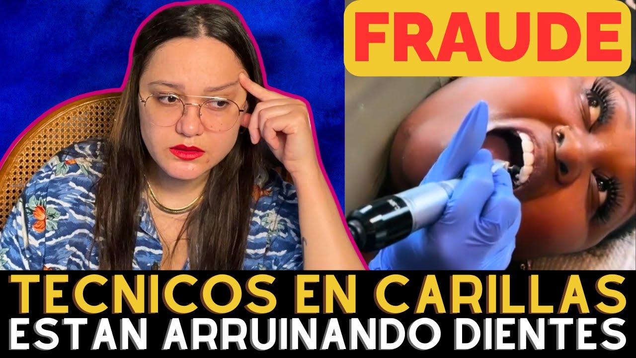 Peligro! Técnicos En Carillas Dentales están arruinando Dientes