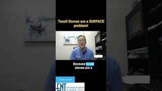 Tired Of Tonsil Stones?